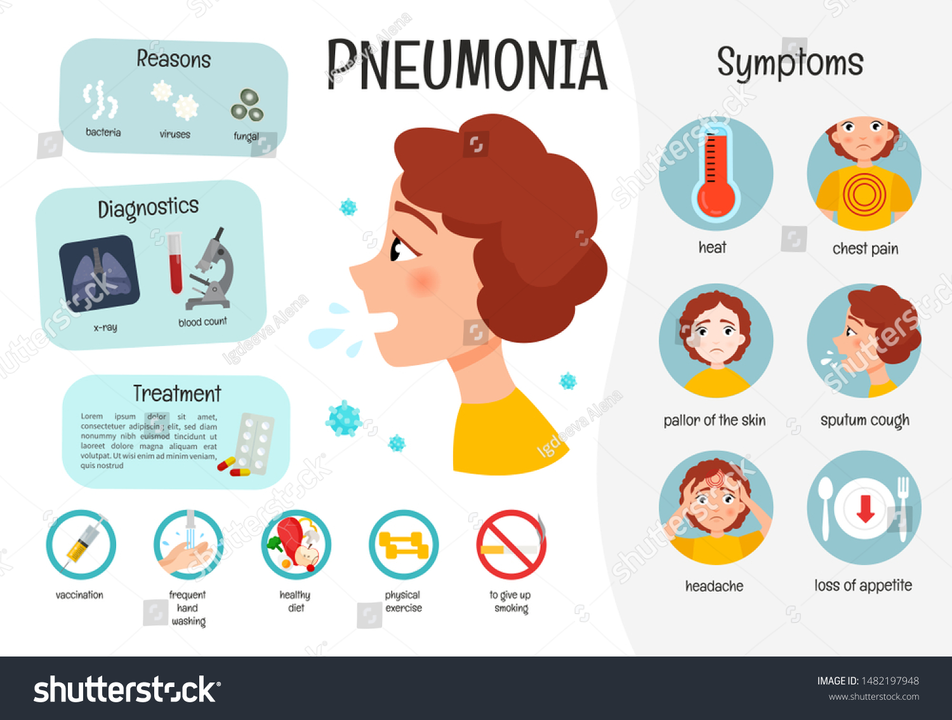 Pneumonia Prevention: Tips for Staying Healthy